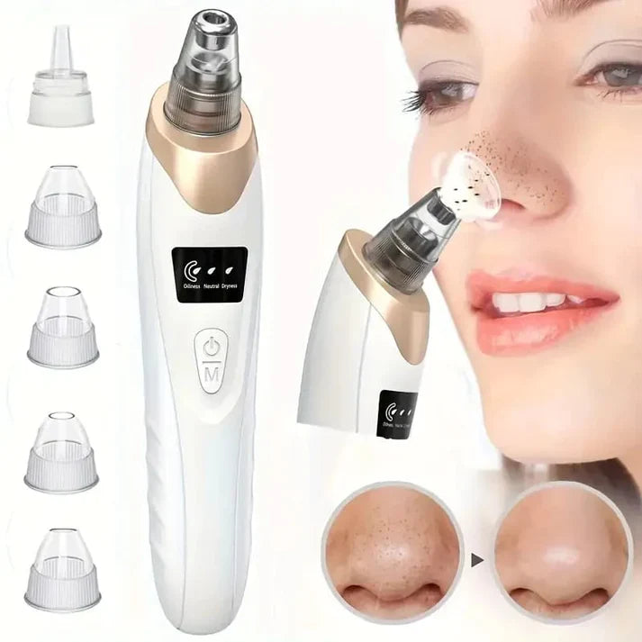 5-In-1 Rechargeable Suction Acne and Blackhead Remover for Men and Women t4trendz