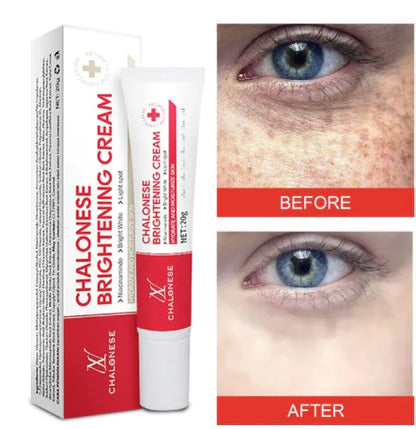 Chalonese Brightening Cream – Buy 1 Get 1 Free