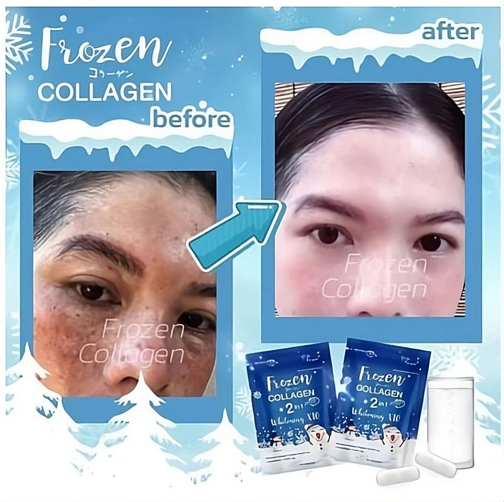 Gluta Frozen Collagen Capcules- Buy 1 Get 1 Free